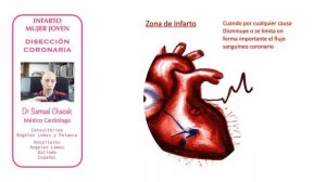 Infarto Cardiaco en Mujeres Jovenes:  Disección Coronaria Espotánea  Dr Samuel Chacek