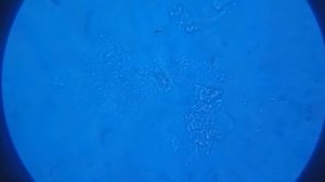 Молочнокислые бактерии под микроскопом
