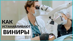 Что такое виниры? Как ставят виниры? Стоматология InSmile
