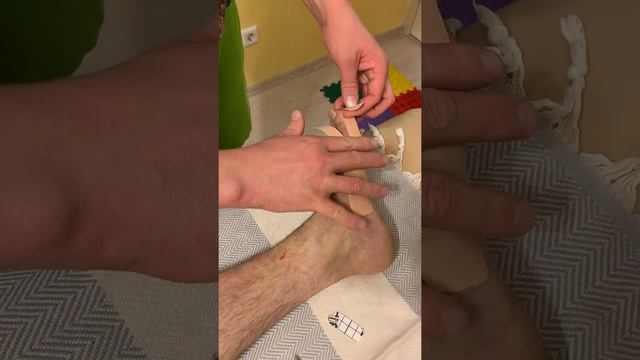 Тейпирование при Hallux valgus. смотреть онлайн
