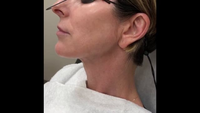 Tokarz Dermatology - Sun Spots SplendorX смотреть онлайн