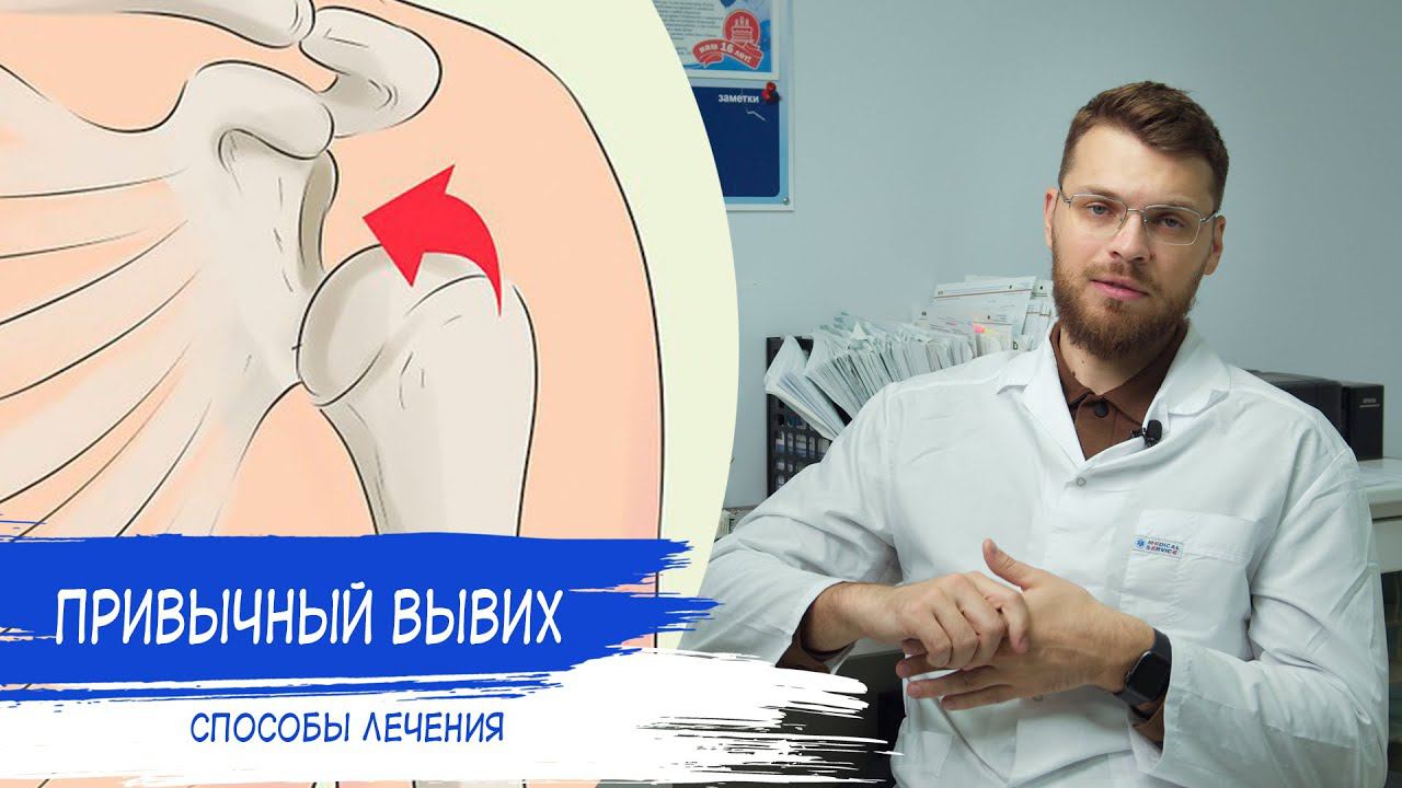 ПРИВЫЧНЫЙ ВЫВИХ ПЛЕЧЕВОГО СУСТАВА | Рецидивирующий вывих плеча смотреть онлайн