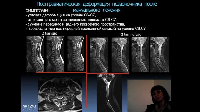 Лекция: "Неотложная МР-томография в условиях больницы скорой медицинской помощи" смотреть онлайн