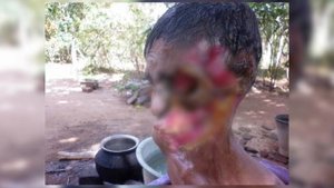 10 САМЫХ СТРАШНЫХ БОЛЕЗНЕЙ