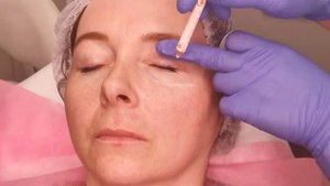 Dermaheal Eyebag Solution uygulamasi
