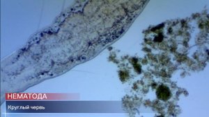 НА ЧТО СПОСОБЕН ШКОЛЬНЫЙ МИКРОСКОП.Вода из аквариума и микроскоп Микромед. Амеба, инфузория и други