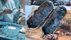 Патологоанатомическое вскрытие расстрелянного петушителя