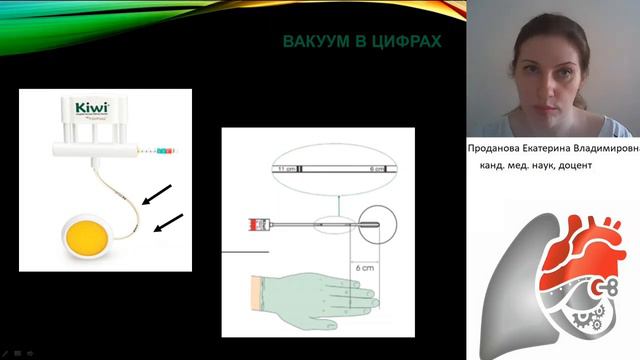 Акушерские щипцы. Проданова Е.В.