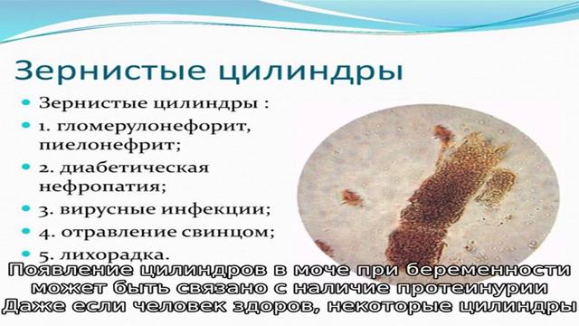 Цилиндры в моче