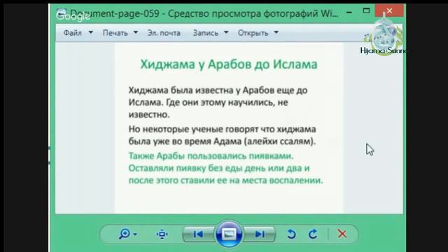 Хиджама у Арабов до Ислама | Обучение Хиджаме