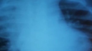 10 Поразительных вещей, найденных внутри человека