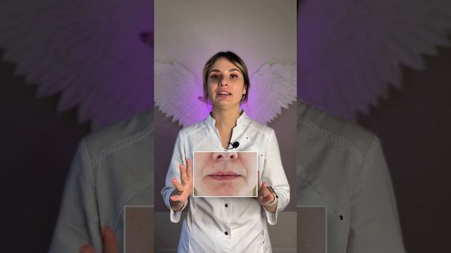Контурная пластика губ только молодых? Или увеличивать губы можно в любом возрасте? Косметология. смотреть онлайн