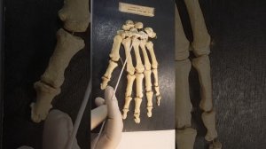 Анатомия#кости кисти#