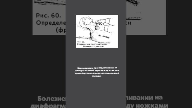 Симптомы острого холецистита | 5 основных симптомов, которые должен знать каждый врач.