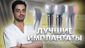 Какие дентальные имплантаты лучше выбрать? Чем они отличаются?