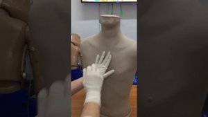 Определение симптома чаши Философова