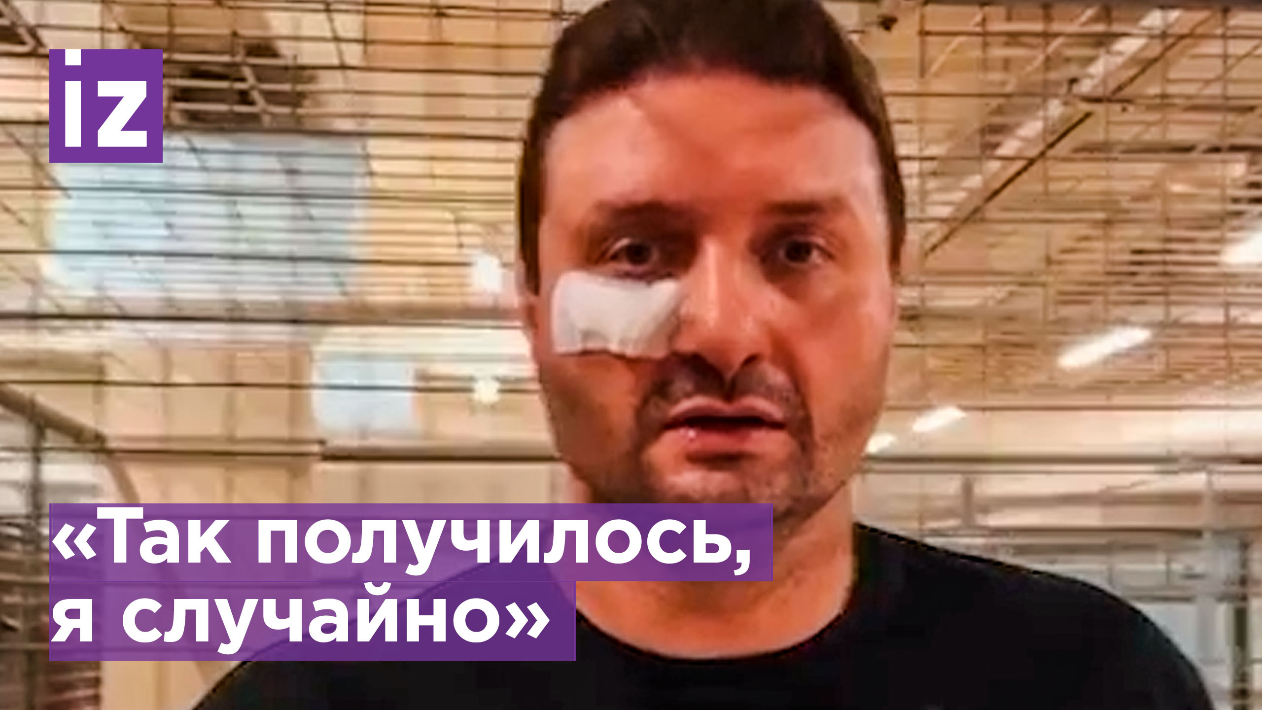 Запашный показал тигра, который его цапнул по лицу / Известия