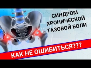 СИНДРОМ ХРОНИЧЕСКОЙ ТАЗОВОЙ БОЛИ: как не ошибиться?