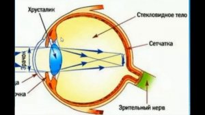 Как лечить дальнозоркость  Эндорфинотерапия