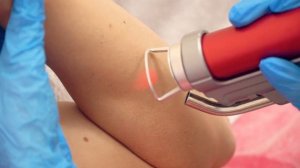 Лазерная эпиляция в клинике Diamond Laser