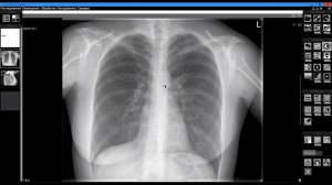 Запись исследований