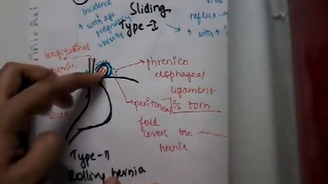 Hiatus Hernia review || oesphagus || git смотреть онлайн