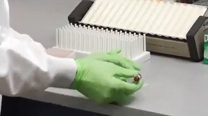 Как правильно делать мазок крови