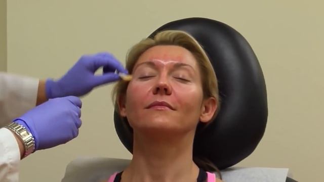 10 Способов Избавиться от Прыщей Навсегда смотреть онлайн