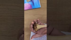 Анатомия . Плечевая кость