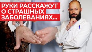 О каких проблемах говорят наши руки? / Как узнать по рукам, чем болен человек?