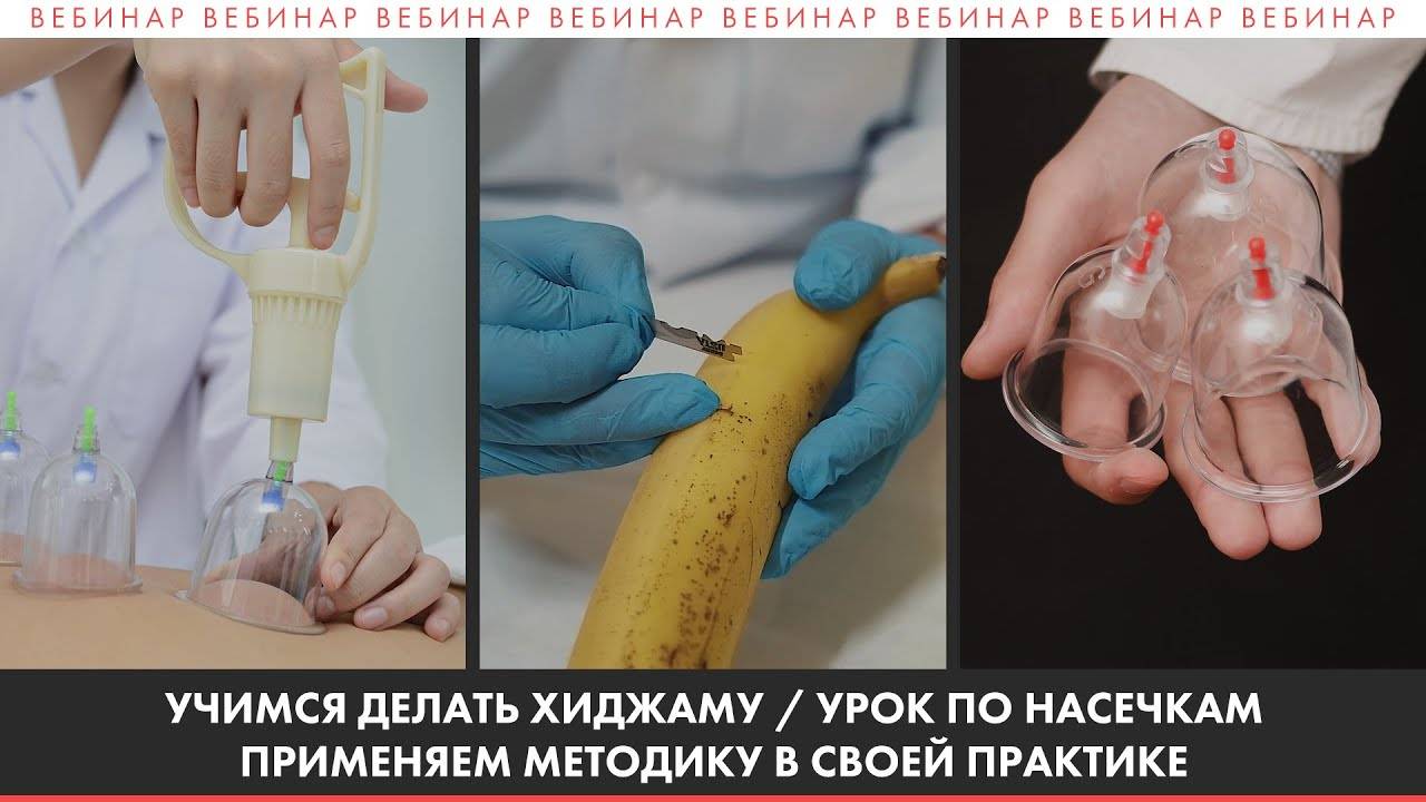 Вебинар по хиджаме + Бонус урок. КАК СТАТЬ МАСТЕРОМ ХИДЖАМЫ.