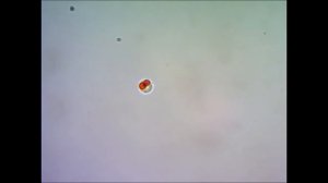 Хламидомонада под микроскопом under microscope