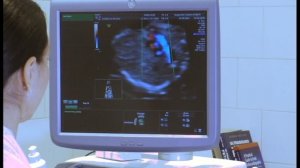 Сравнение качества картинки УЗИ на экспертном и обычном сканере