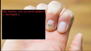 КАК ПРАВИЛЬНО УХАЖИВАТЬ ЗА ДЕТСКИМИ НОГТЯМИ | 8 главных вопросов о детских ногтях