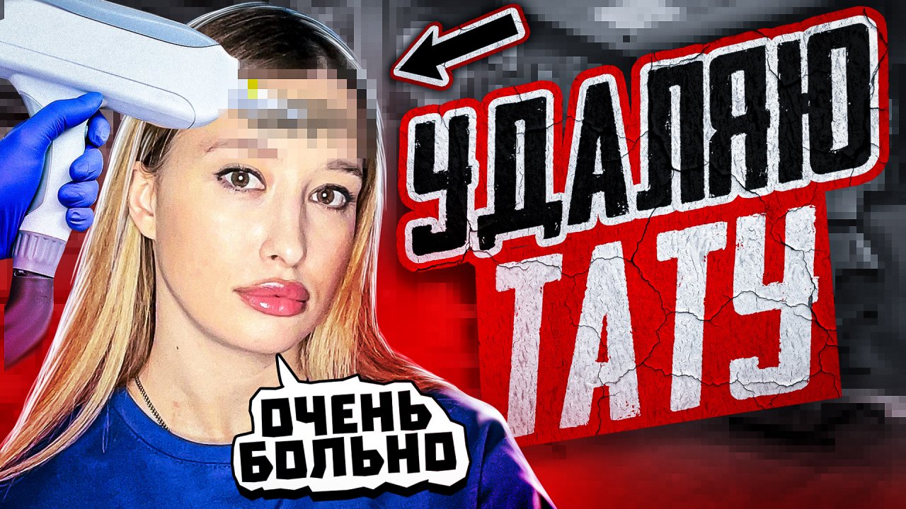 УДАЛЯЮ ТАТУ!