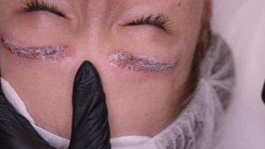 Удаление перманентного макияжа бровей ремувером Hanafy | Мастер PMU Анна Рынденко