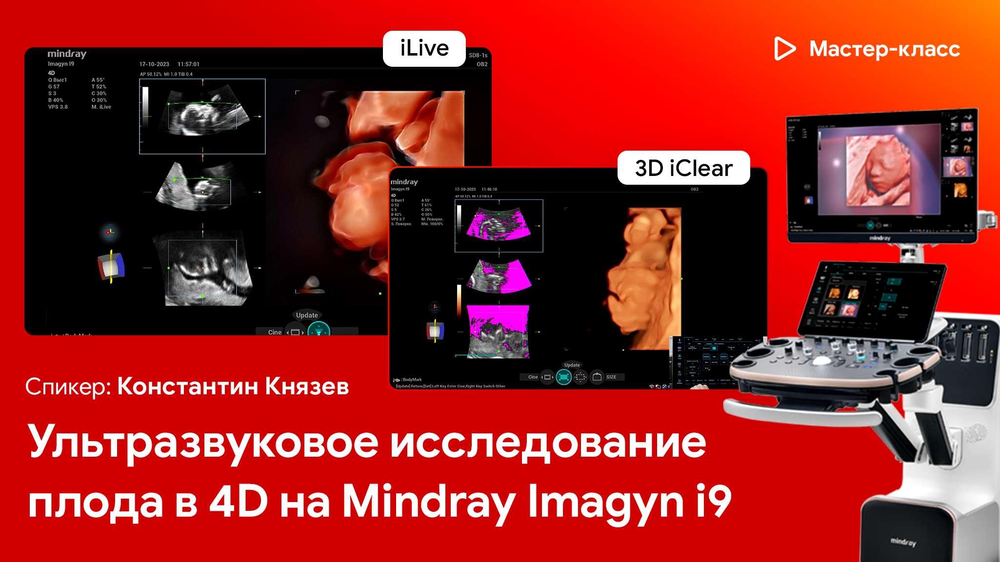 Ультразвуковое исследование плода в 4D на Mindray Imagyn i9