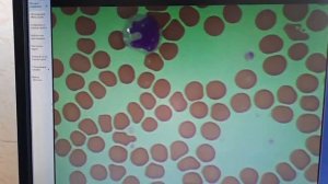 Подсчёт лейкоцитарной формулы с нуля