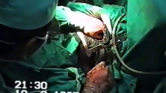 Ранение сердца и лёгкого смотреть онлайн