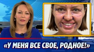 Появились первые фото Виктории Бони после пластики лица