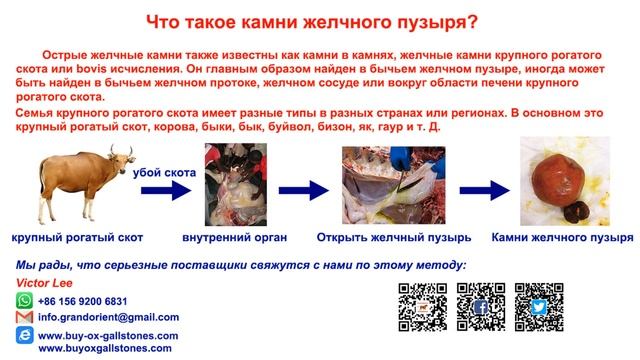 Мы покупаем камни в желчном пузыре смотреть онлайн