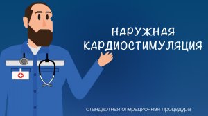 СОП - Наружная кардиостимуляция