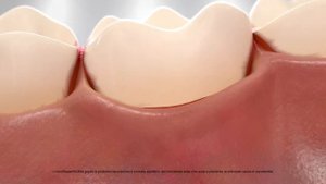 Biorepair Peribioma - MESE PROTEZIONE DELLO SMALTO 2021