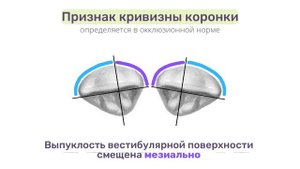 Определение принадлежности зуба к правой/левой стороне зубного ряда | CARVIDENT