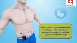 Инсулиновая помпа при сахарном диабете_ устройство, принцип работы и профилактики гипогликемии