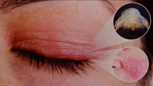 Демодекс смотреть онлайн