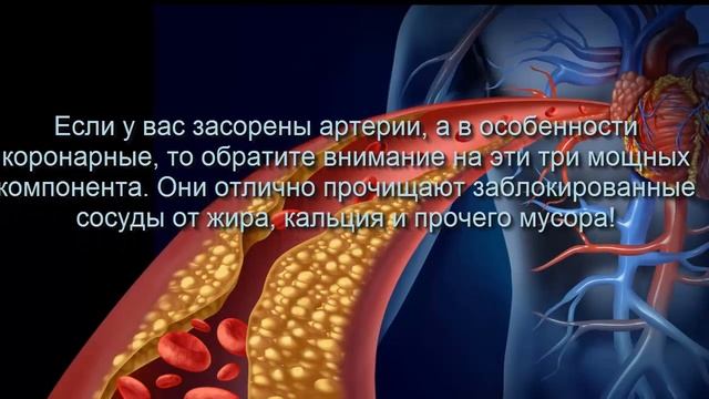 Как прочистить заблокированные артерии за одну неделю в домашних условиях смотреть онлайн