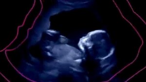 Развитие эмбриона на 4 м месяце беременности - 2 триместр