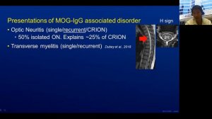 Optic Neuritis -  Dr. John Chen - Clinica Mayo, USA