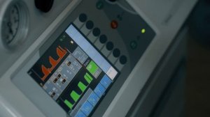 Трансцервикальная гистероскопическая резекция субмукозного узла миомы матки